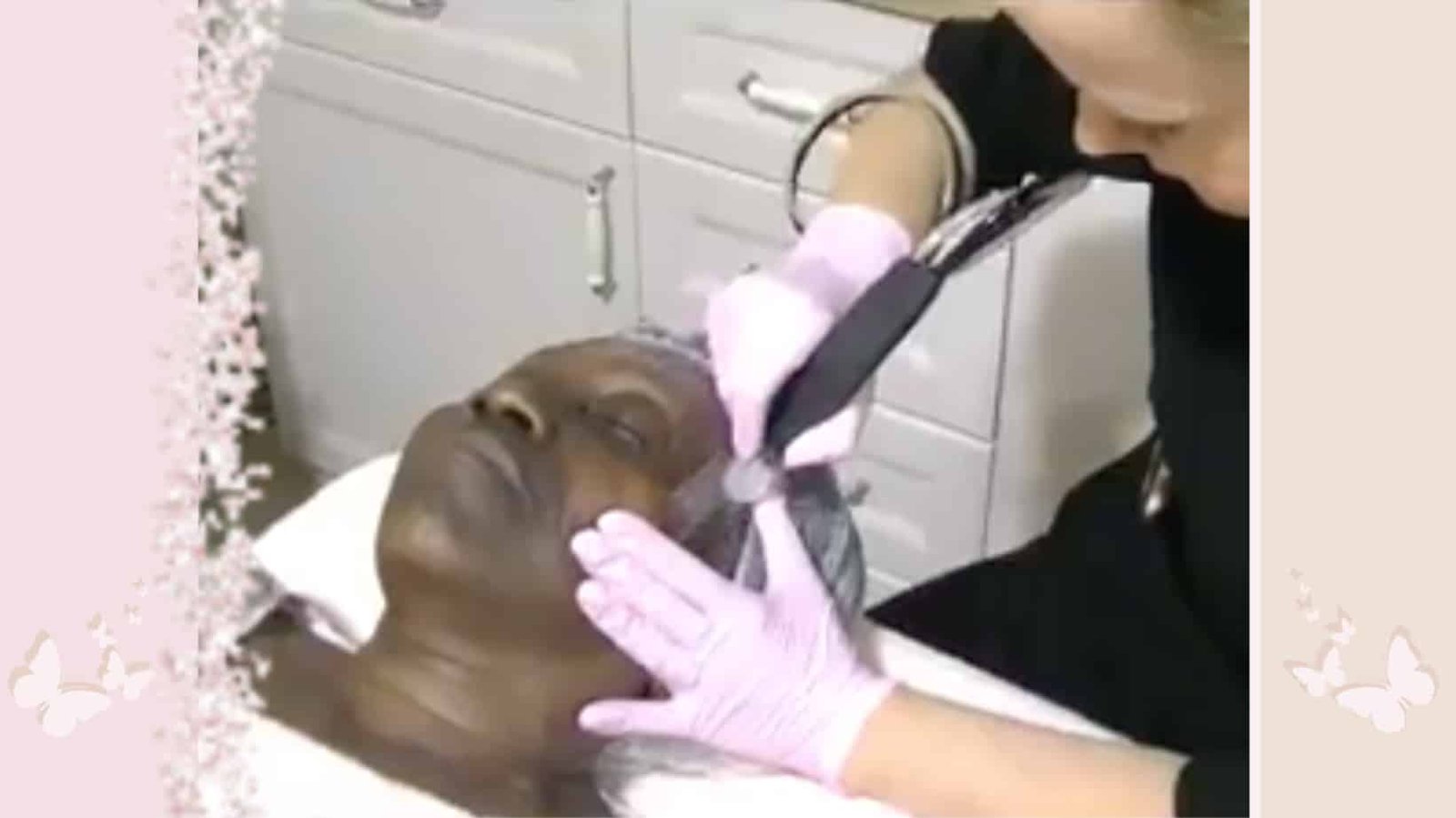 wat is microdermabrasie wat is microdermabrasie